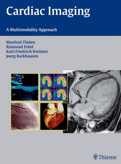 Cardiac Imaging - A Multimodality Approach